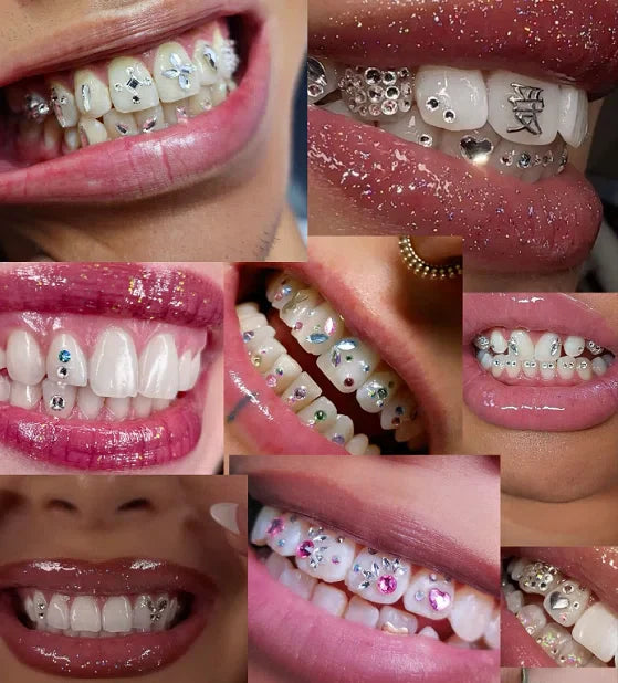 Tooth Gems: What They Are, Safety, Cost & Aftercare Guide