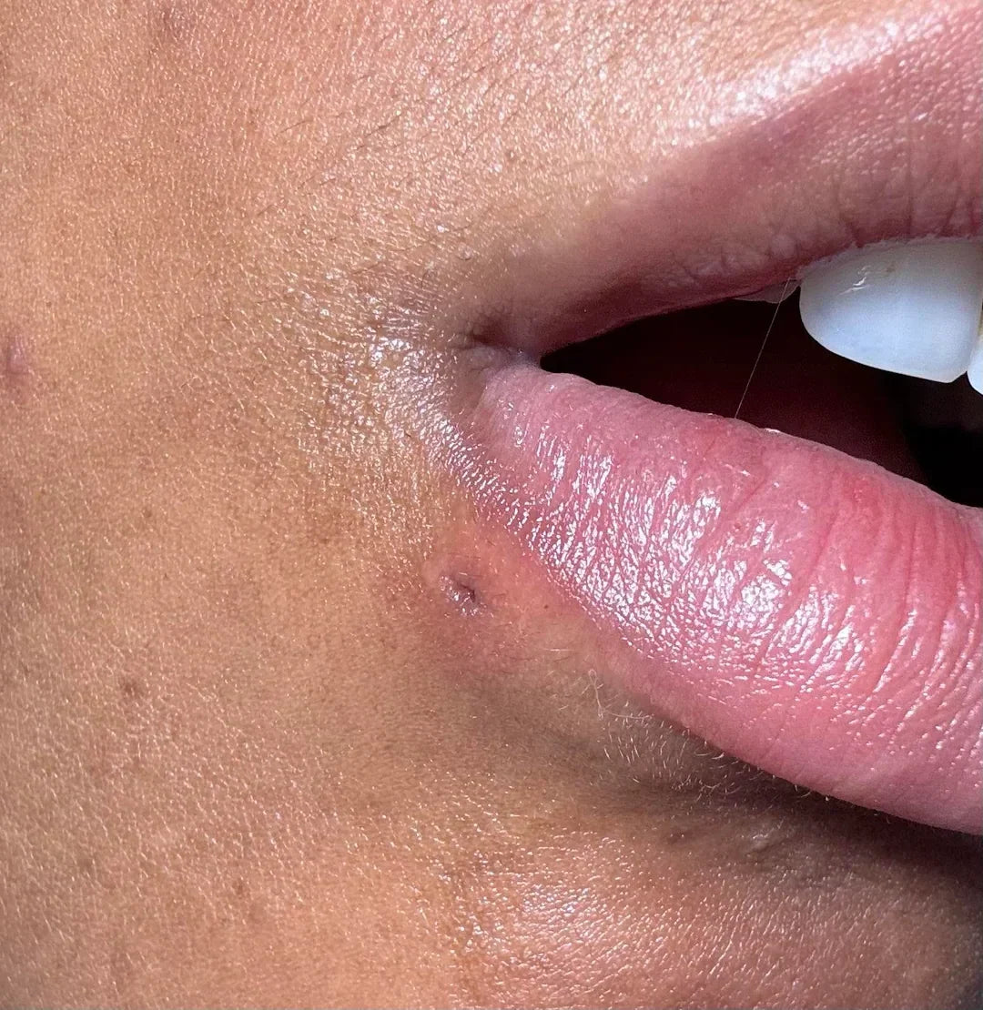 My Piercing Closed: Can It Be Reopened or Re-Pierced?